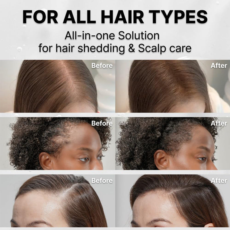 Korea's Hair Growth Serum