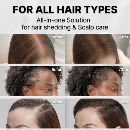Korea's Hair Growth Serum